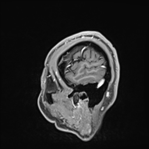 Click on the Serie image to view the images of VILLANUEVA, WILLIAM A.